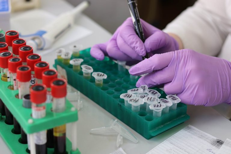 Studie: minderheden structureel ondervertegenwoordigd in kankeronderzoek