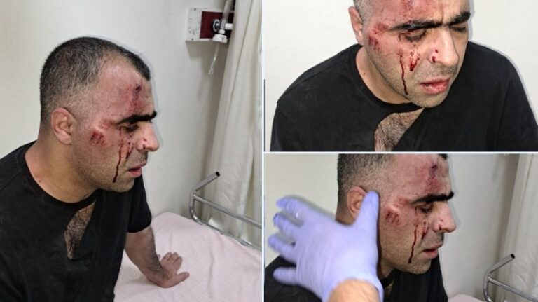 Koerdische journalist mishandeld door AKP-bodyguards
